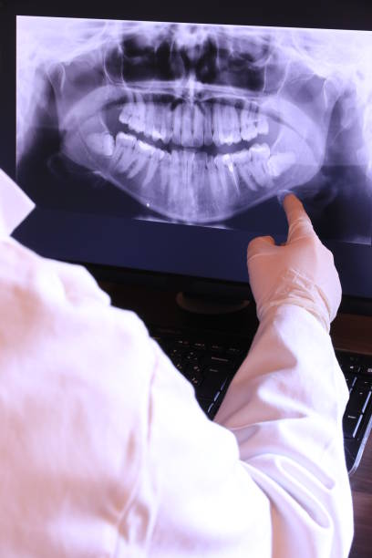 Best Emergency Treatment for Oral Infections in Desnso, CA